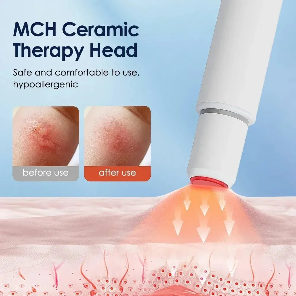 Infrared Pulse Thermal Anti-Itch Pen - Chemical-Free Bug Bite Relief Stick